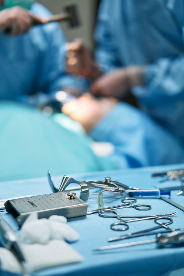 PEG - Medizinische Geräte PEG - Medizinische Geräte während einer Operation